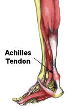 achiles tendon